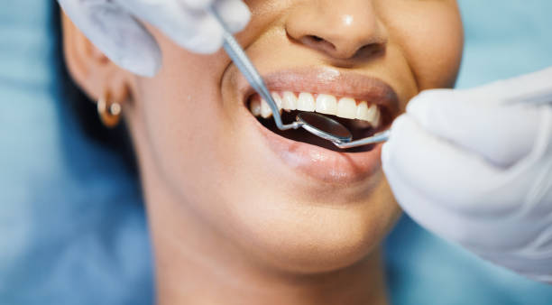 Best Emergency Dental Care for Broken or Chipped Teeth in Dripping Springs, TX